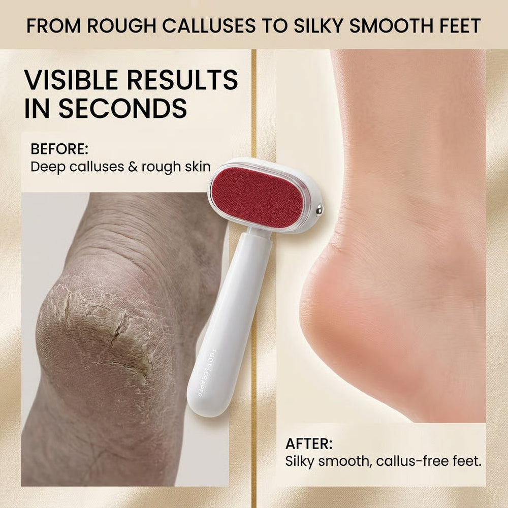 SmoothStep Foot Callus Remover - product photo 2